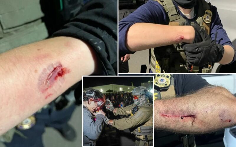 Anti-ICE Agitator Charged With Biting Officers During Protest