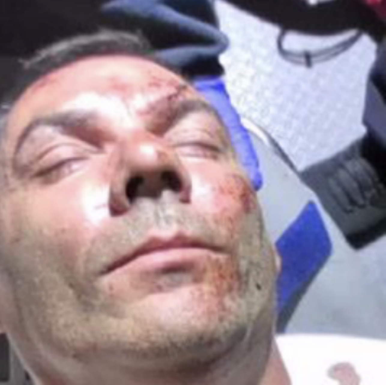 ICE