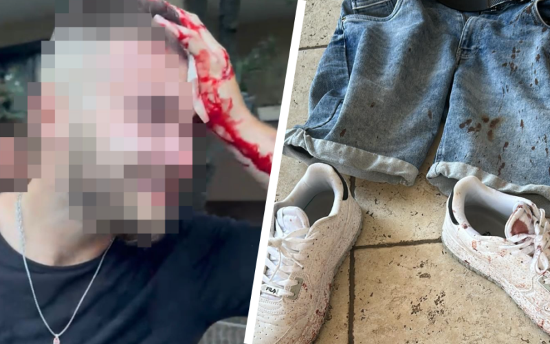 Conservative Group Attacked by Left-Wing Extremists at Dinner