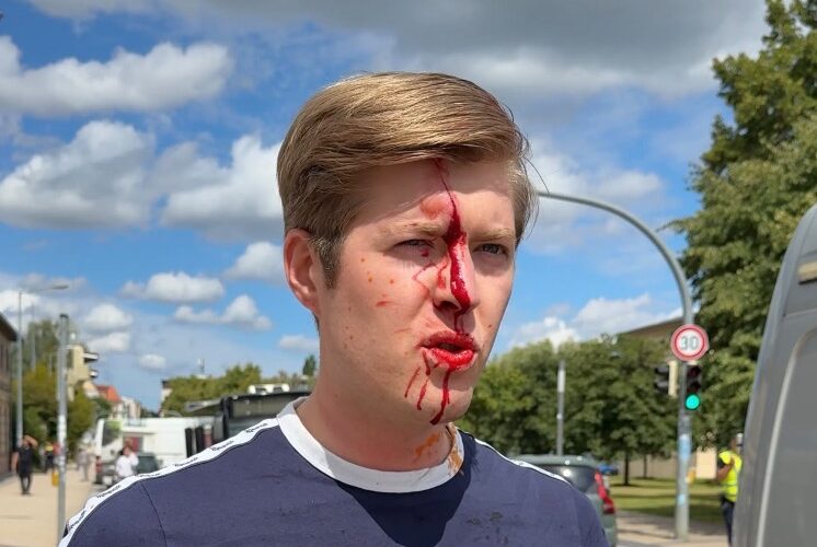 Bloody Antifa Attack on AfD Youth Organization Member